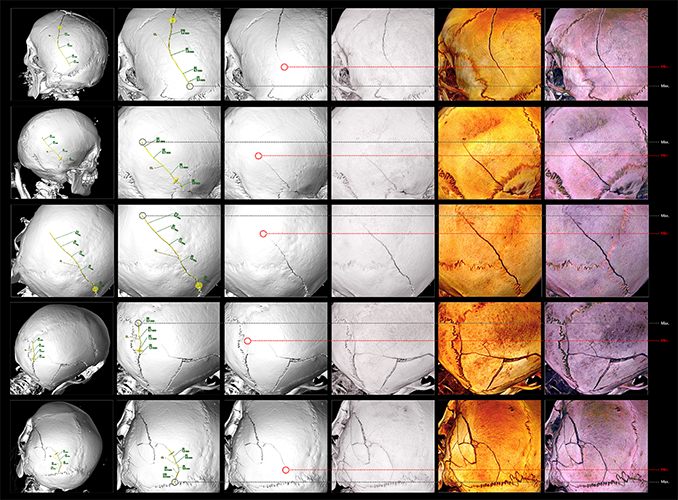 Colour and Knowledge in Virtual Autopsy (Virtopsy)