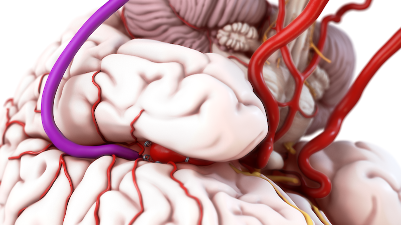 Gyri, Sulci et Arteriae